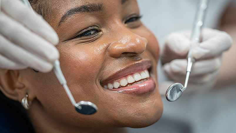 Veneers